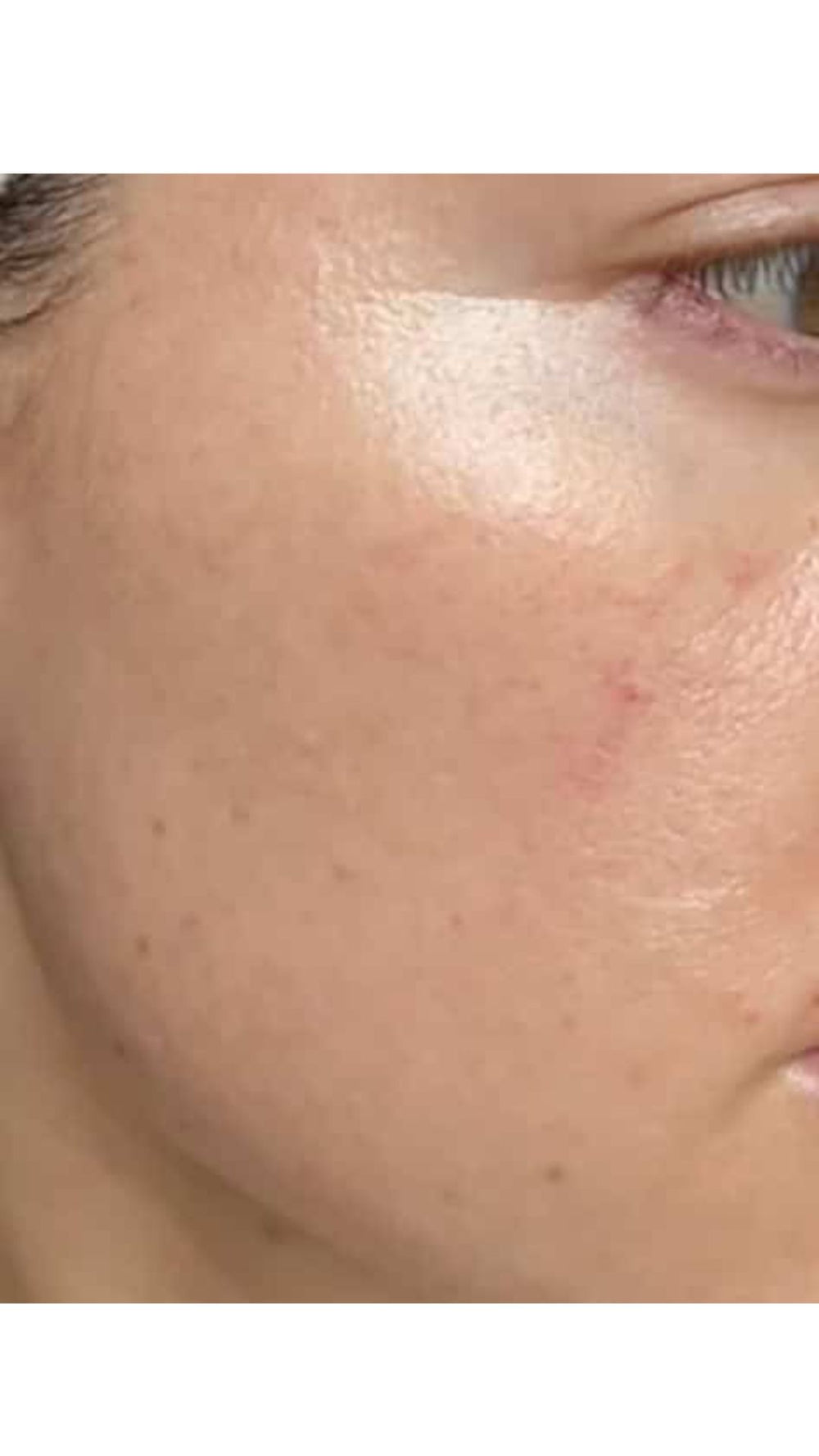 After consistent treatment