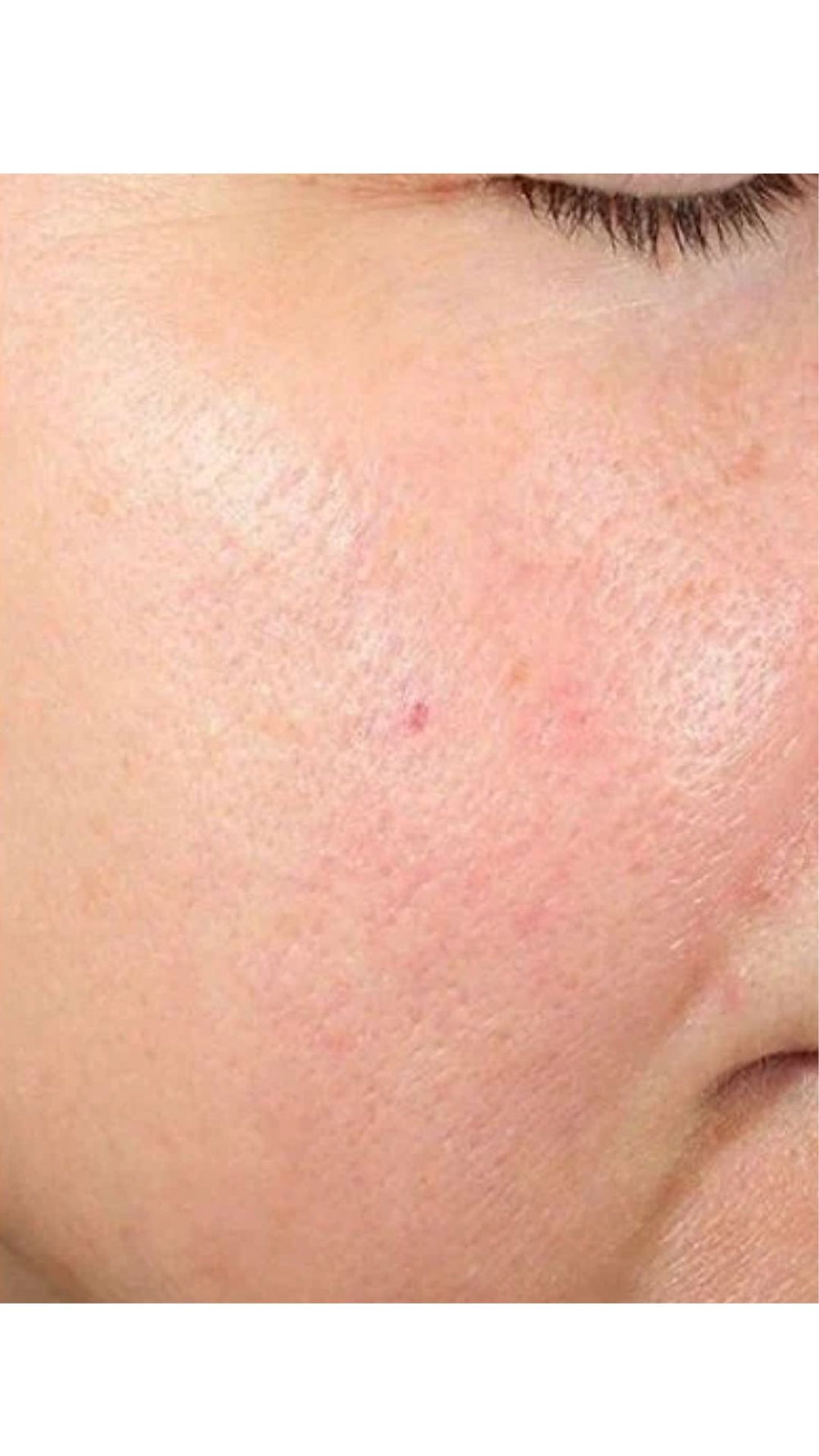 After consistent treatment