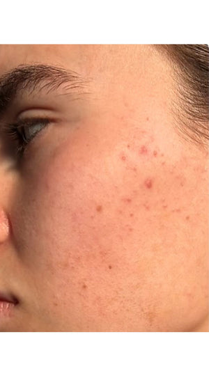 Before - Amazing Results!