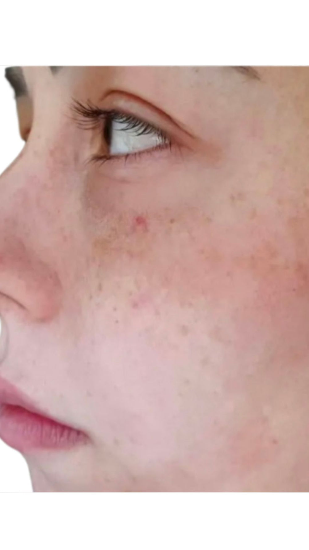Before treatment