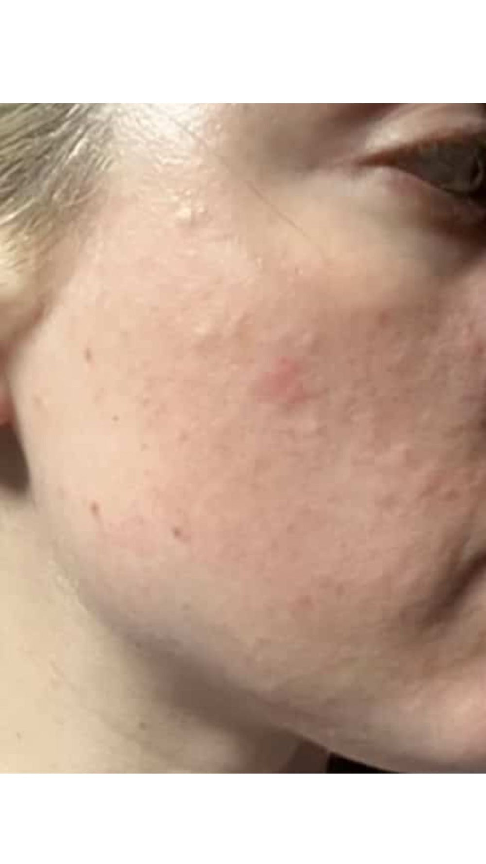 Before treatment