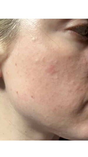 Before - Incredible Difference!