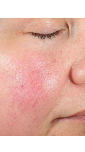 Before - Works Wonders!