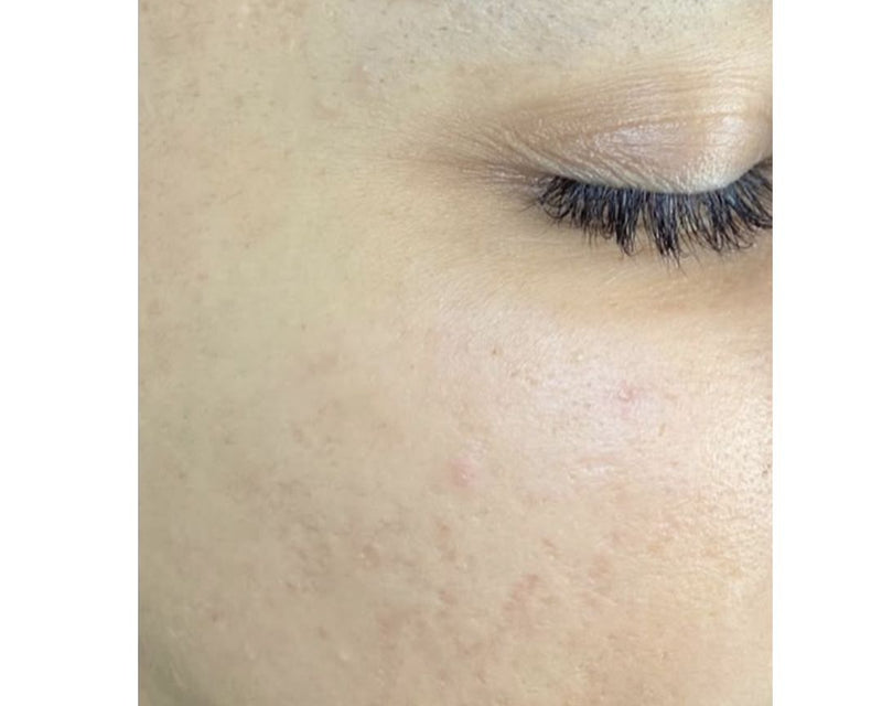 Omega light LED before & after